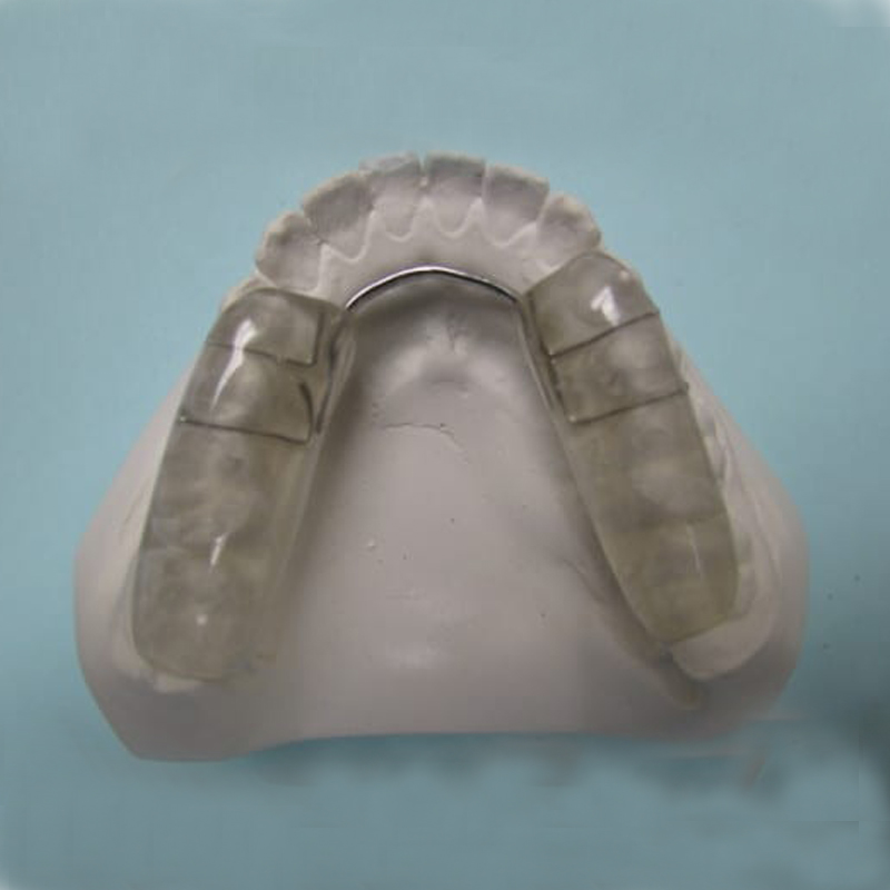 occlusal splints کا کردار