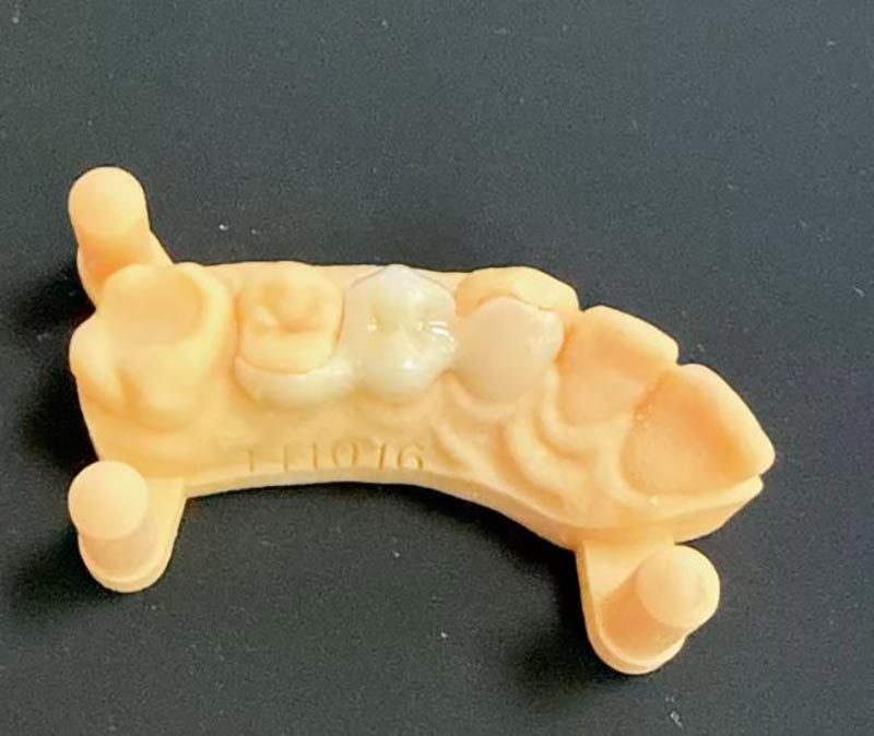 میری لینڈ پلوں کے بارے میں آپ کو کیا جاننے کی ضرورت ہے؟