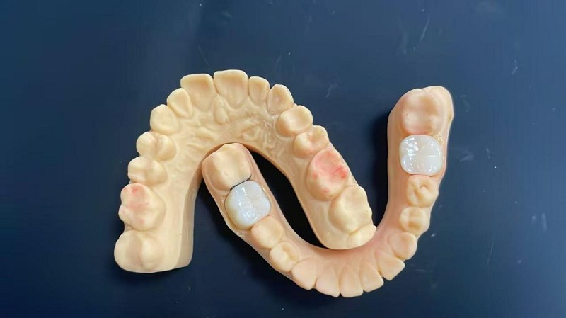 کندھے کا کنارے کیا ہے؟