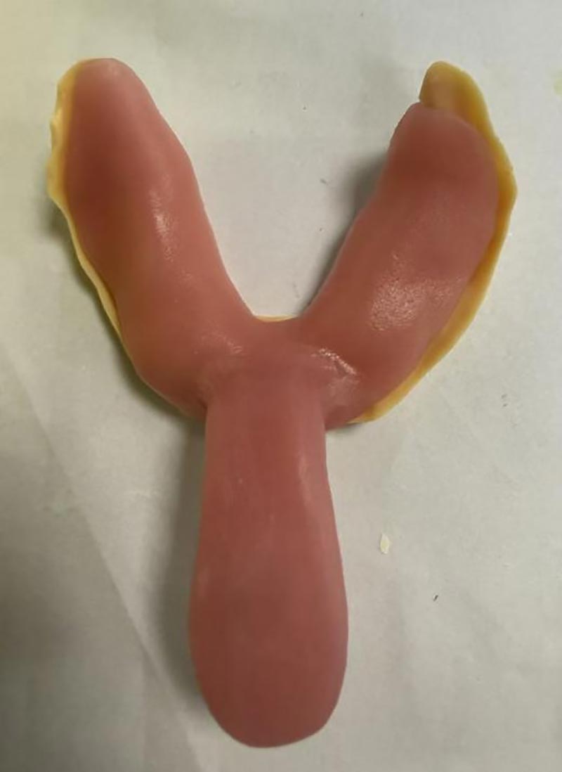 وہ چیزیں جن کو آپ کو کسٹم دانتوں کی ٹرے کے بارے میں نہیں معلوم تھا