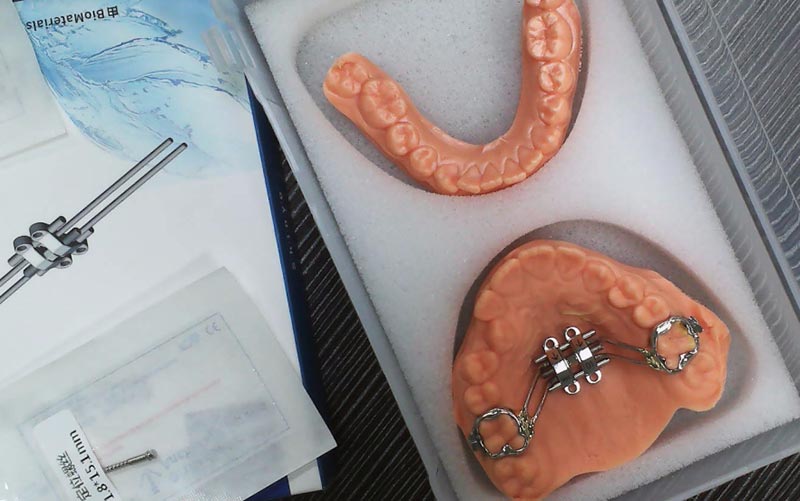 WM ڈینٹل لیب کے ساتھ MSE سکیلیٹل ایکسپینشن کو سمجھیں۔