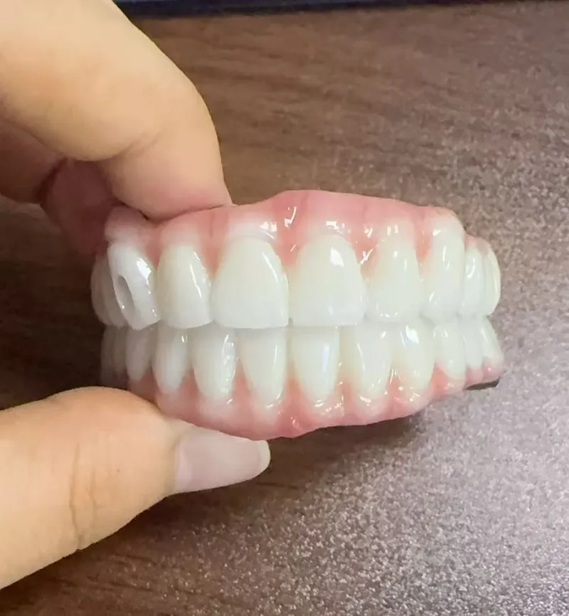 Malocclusion کے خطرات