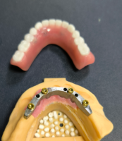 لوکیٹر اور ڈینٹل بار