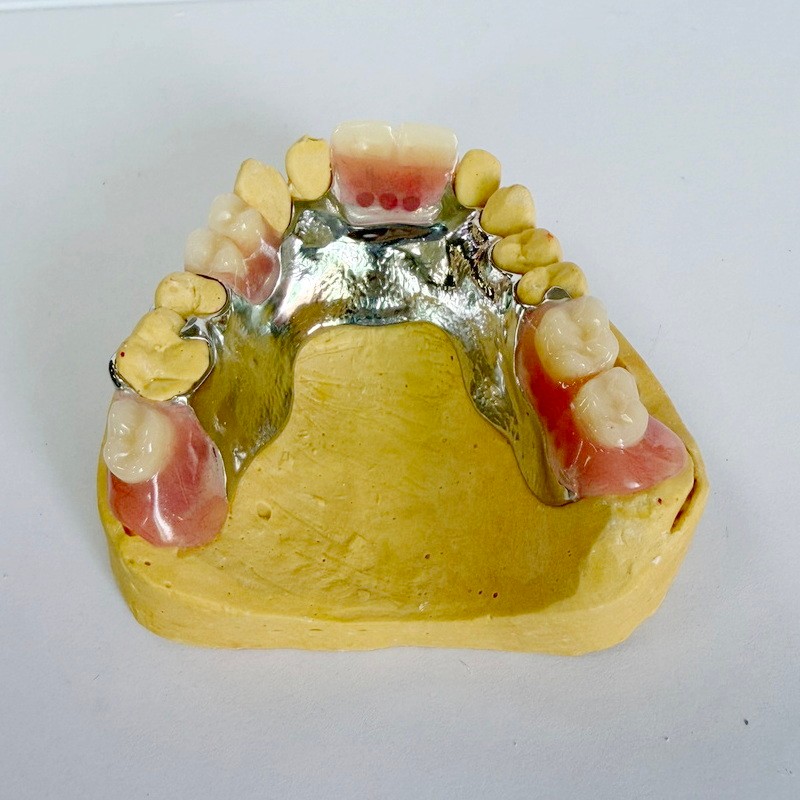 ہٹنے والا بحالی جزوی فریم ورک